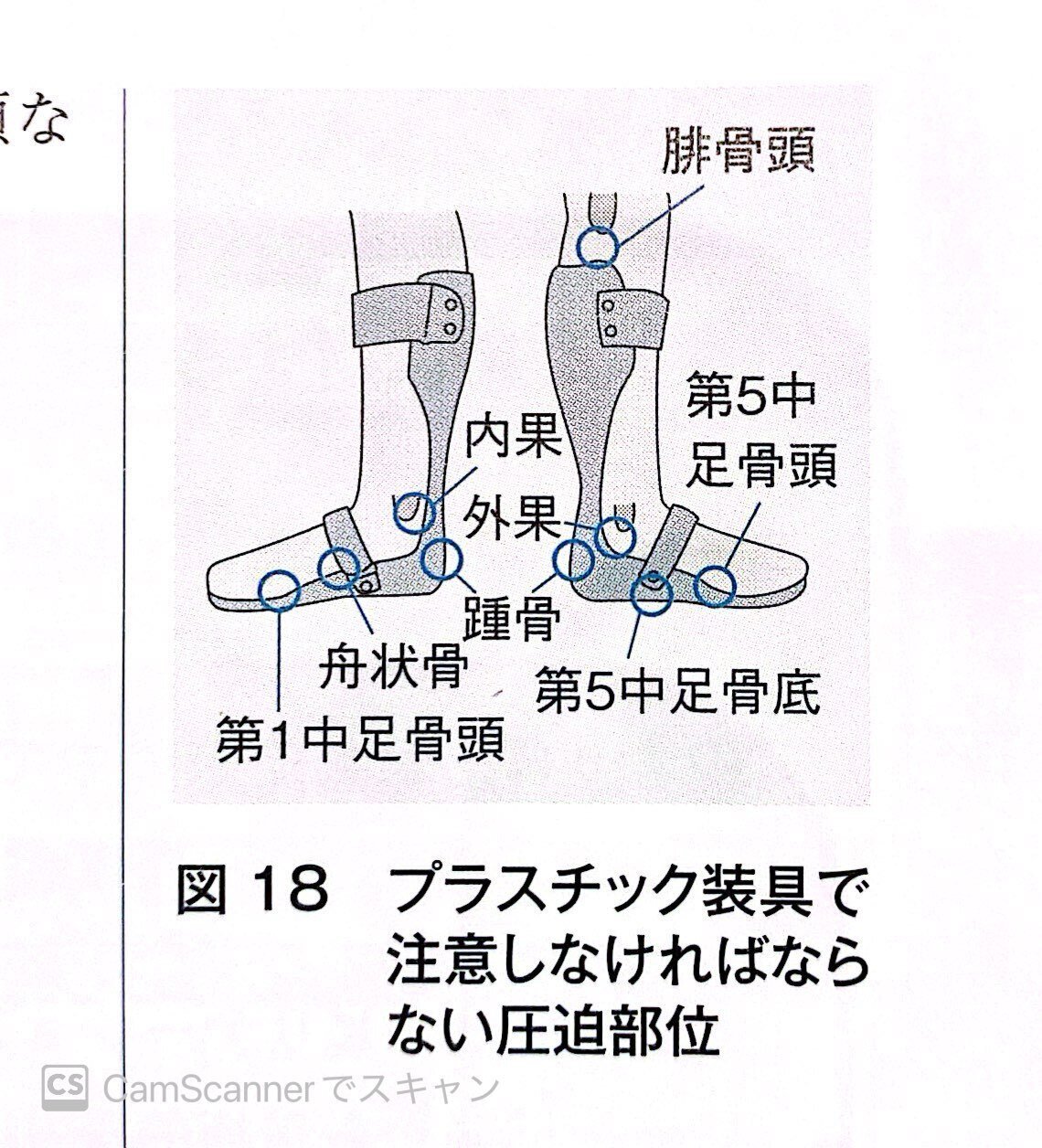 装具 右足 タマラック 23.5〜24.0センチ タマラックAFO背屈ストップ