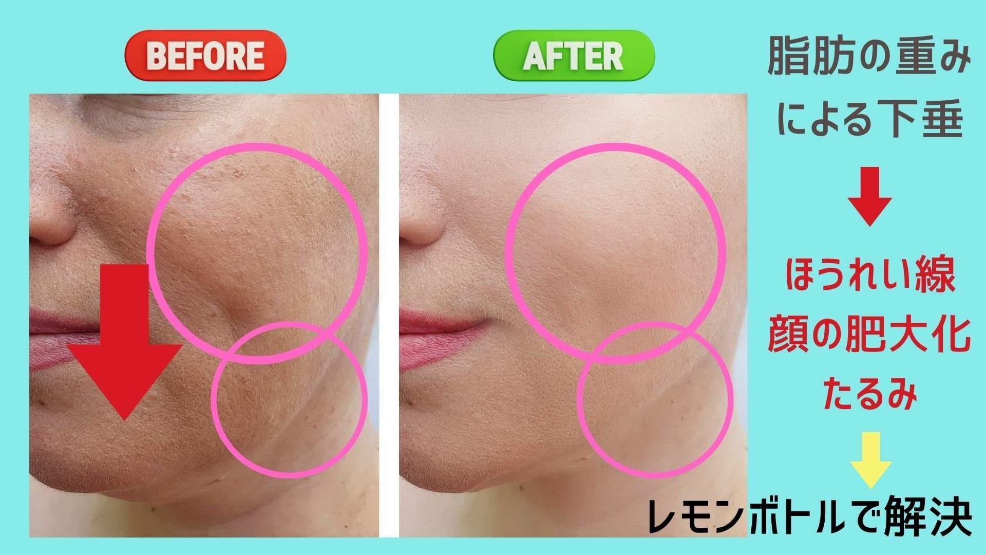 脂肪溶解剤レモンボトルって何?|【美容×疲労回復】を追求した 脂肪溶解剤レモンボトルって何?|【美容×疲労回復】を追求した