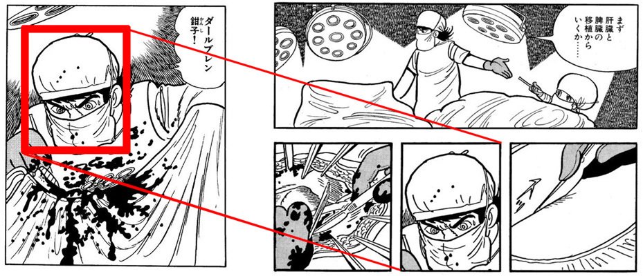 消されたマンガ＋オマケ ブラックジャック 封印作品 ブラックジャック大全集」解説② 幻の未収録作やレアシーン収録