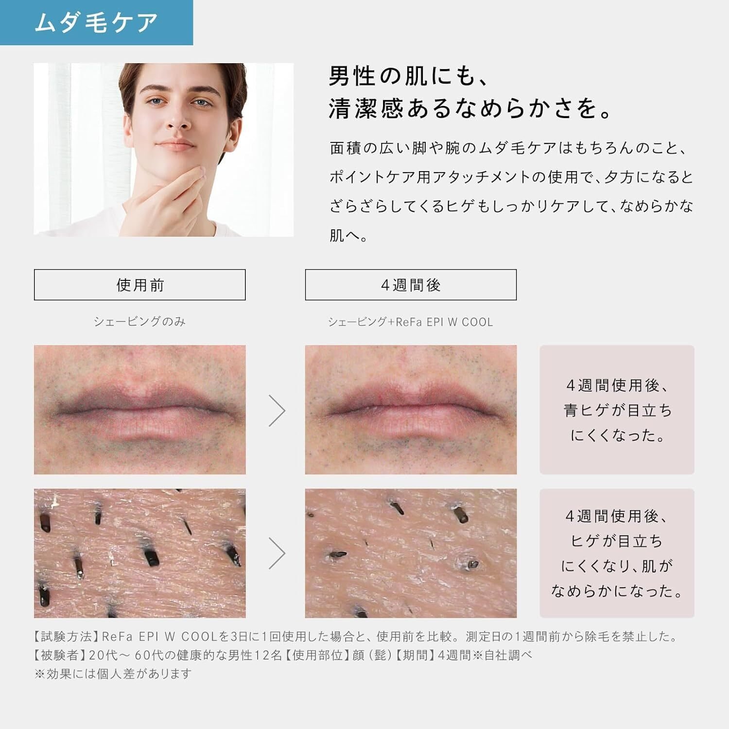 ぴ様 ReFa EPI W COOL リファエピダブルクール 美肌脱毛器 ReFa 【冷却機能搭載！】 リファ エピ クール 光美容器 公式