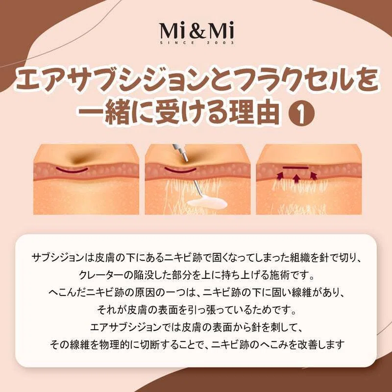 「施術説明」【エアサブシジョン＆フラクセル】ニキビ跡のない綺麗な素肌で自信もアップ！｜𝕞𝕚𝕟𝕞𝕚 ℂ𝕝𝕚𝕟𝕚𝕔 𝕆𝕗𝕗𝕚𝕔𝕚𝕒𝕝 | 美容 ...