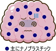 認知症の人の脳とナノプラスチックのイメージ(くま作/脳チャオ☆)