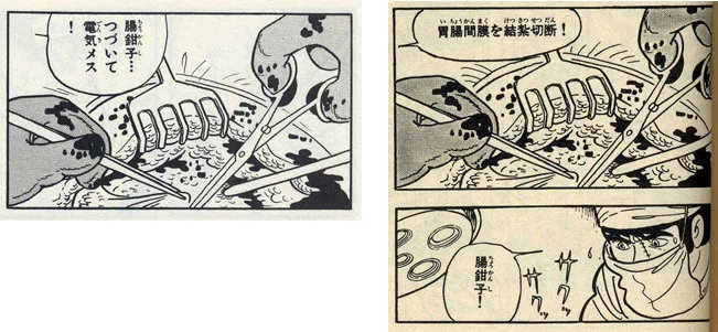 ブラック・ジャック』の改変事例①｜イカサマタコサマ
