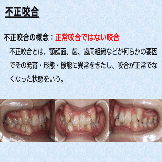 咬合の謎を解く! なぜ、咬合は見た目で診断できないのか? 咬合の謎を解く！ - クインテッセンス出版
