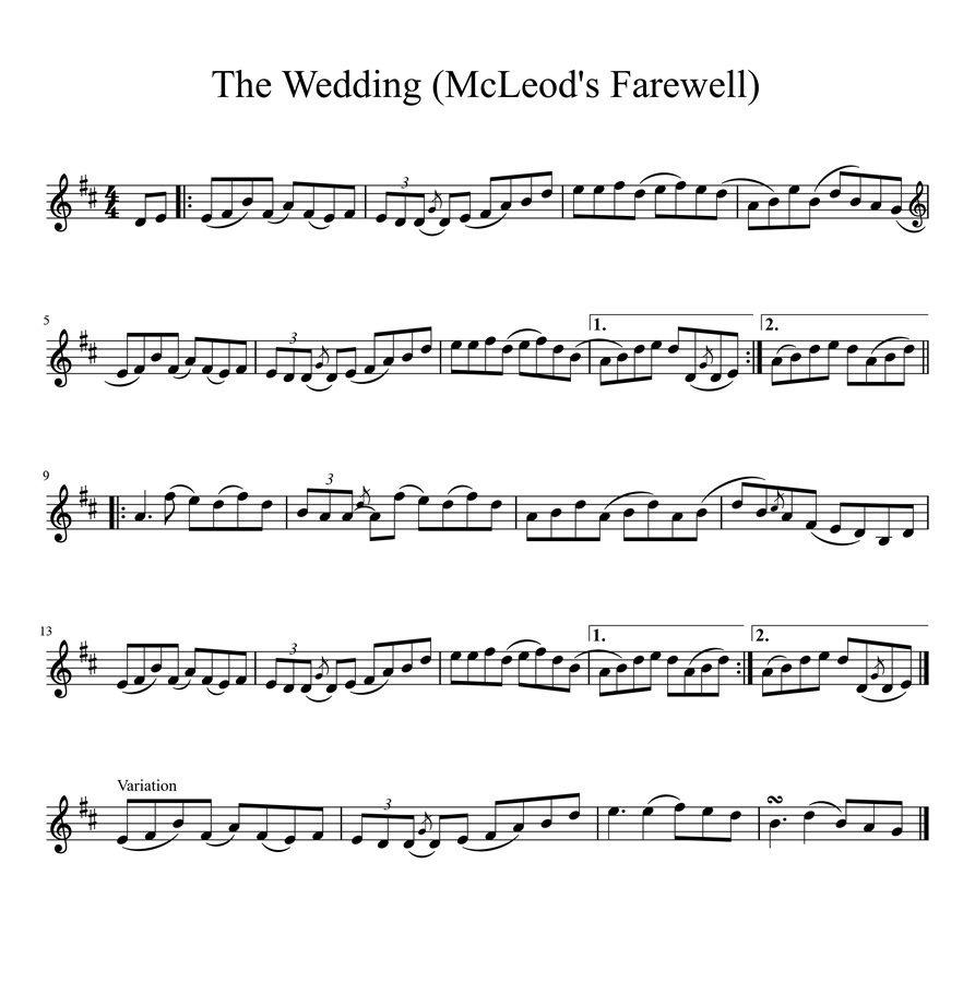 耳で覚えるか、楽譜を使うか｜井上 陽介