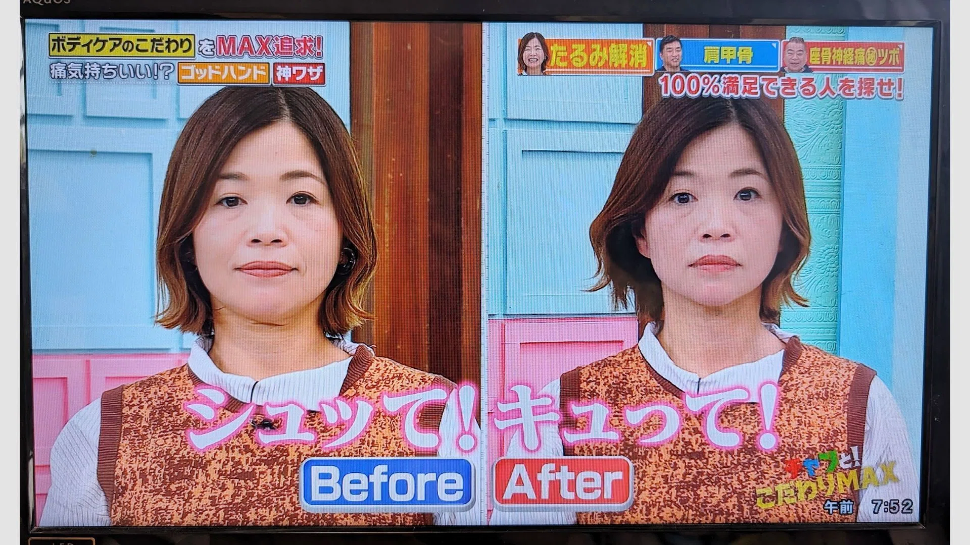 たるみ改善しすぎてテレビ出演：自己紹介｜#小顔ドクター®