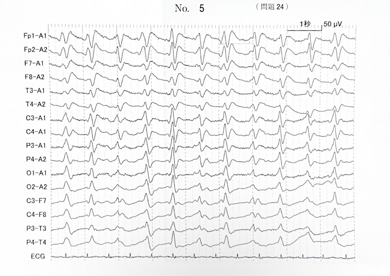臨床検査技師国家試験うら解答【第62回〜第71回/10年分セット＋模試3回分】 臨床検査技師国家試験裏解答【第61回〜第67回/7年