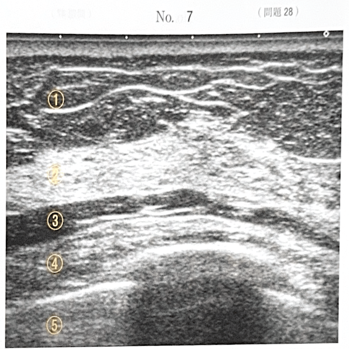 2025第71回臨床検査技師国家試験解説【臨床生理学編】#16〜28｜そらち
