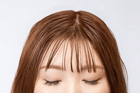 ビフォーアフター掲載】前髪もお肌もさらっとキレイ！「アイエム