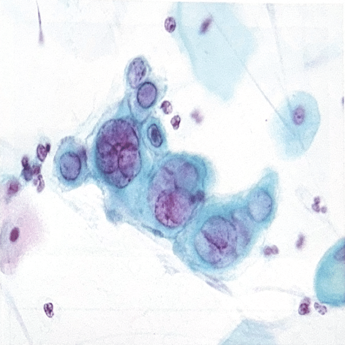 2025第71回臨床検査技師国家試験【病理組織細胞学】#45〜58｜そらち