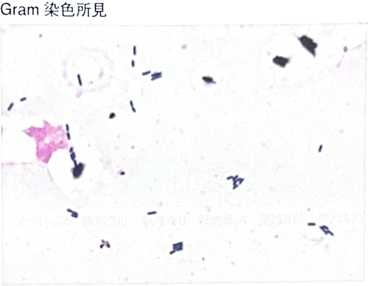 2025第71回臨床検査技師国家試験【臨床微生物学】#68〜78｜そら