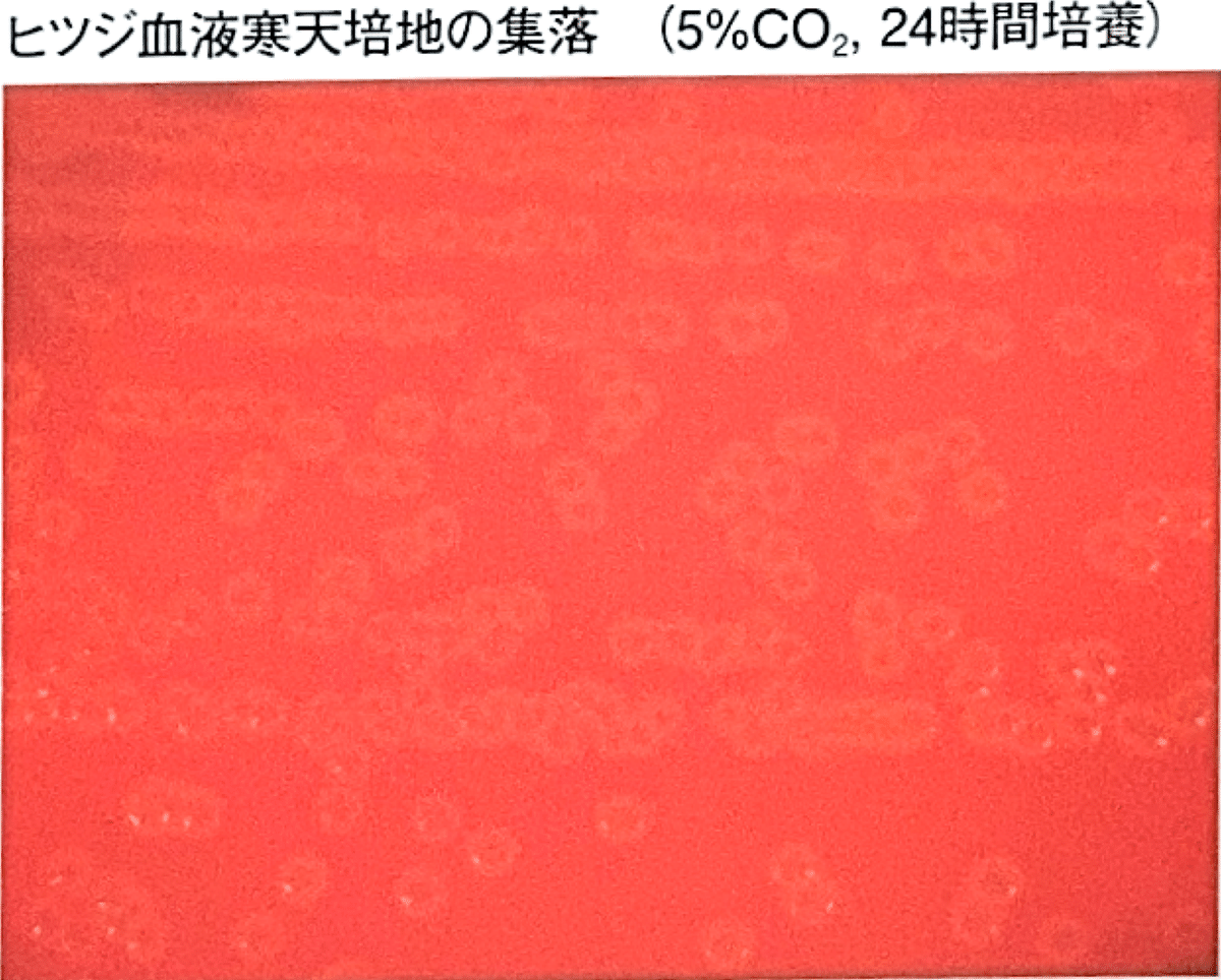 幅広い微生物検査を目指して―検出頻度は低いが医学的に重要な細菌・真菌感染症の検 2025第71回臨床検査技師国家試験【臨床微生物学】#68〜78｜そら