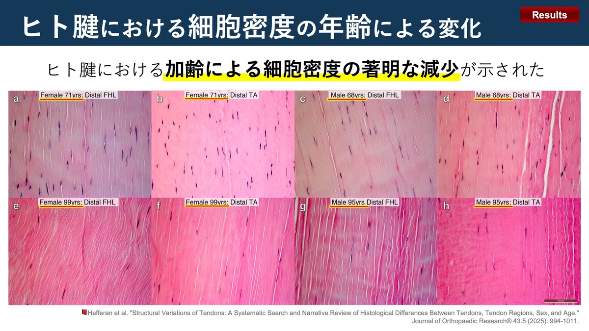 腱の構造大全。機能的役割、部位、加齢による違い。|Super Human | 理学療法士/保健学博士 Ph.D.