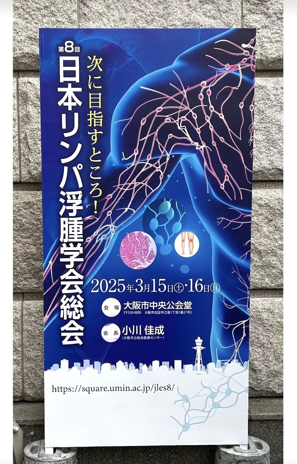 日本リンパ浮腫学会総会｜ルネサンス 運動支援センター~ がん