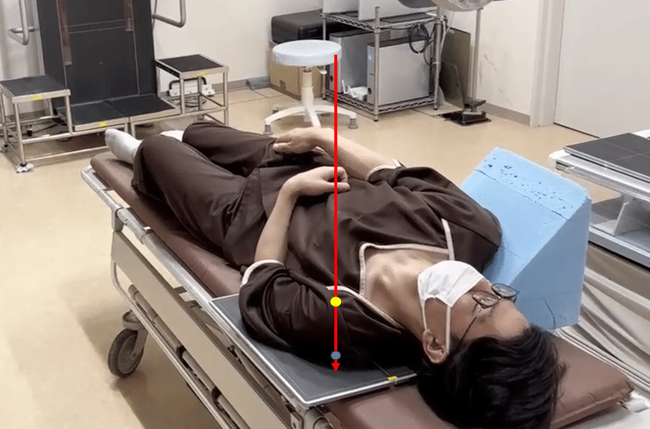Instruction Manual] X-ray Imaging on a Stretcher - Shoulder X-ray
