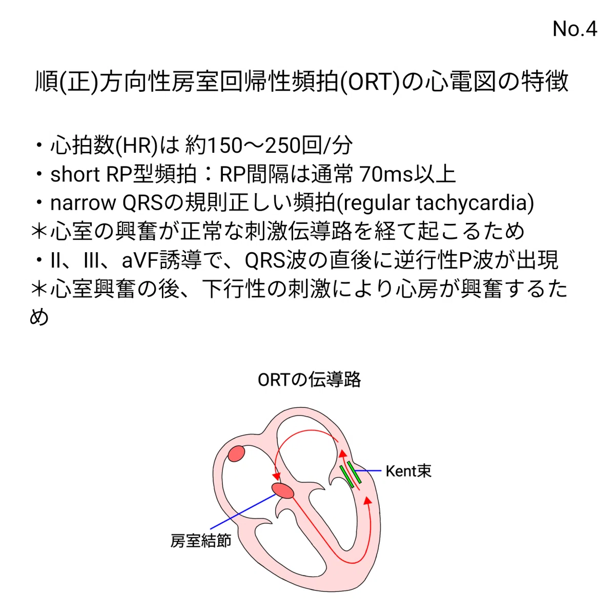 心電図検定1級合格用note|医師マイケル 心電図ブログ