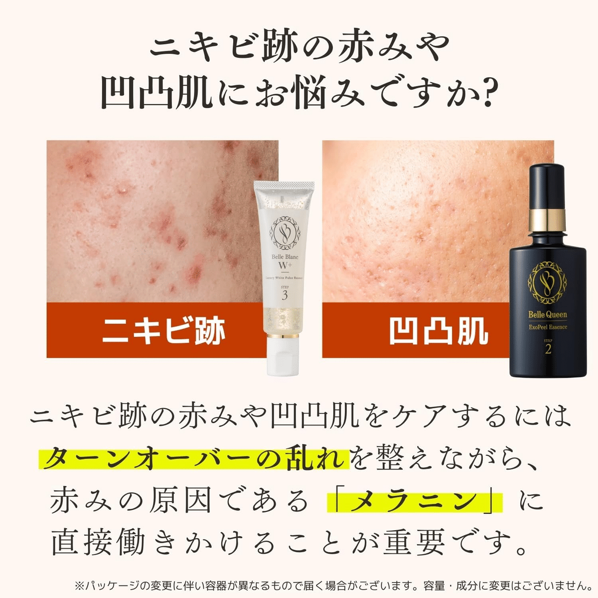 2025年最新】ニキビ跡・クレーター・色素沈着が気になる人に
