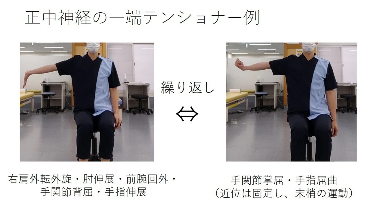 神経モビライゼーションの基本｜理学療法｜リハログの森｜理学療法士