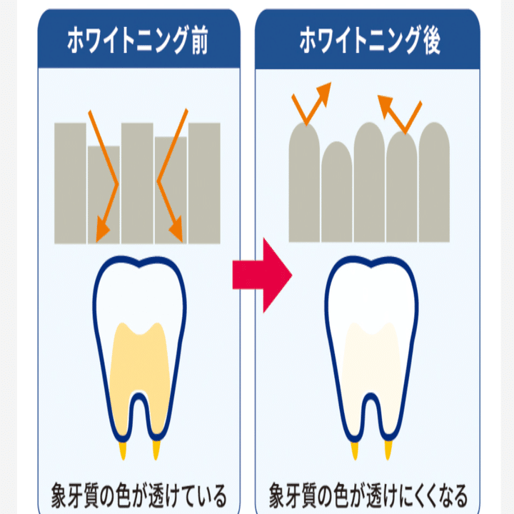 kobutamamaさん専用！ディノベートホワイトニングジェル ディノベート ホワイトニングジェルパックの口コミや評判は？｜効果と