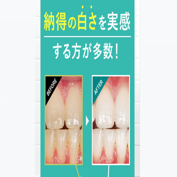 ディノベート ホワイトニングジェルパックの口コミや評判は？｜効果と