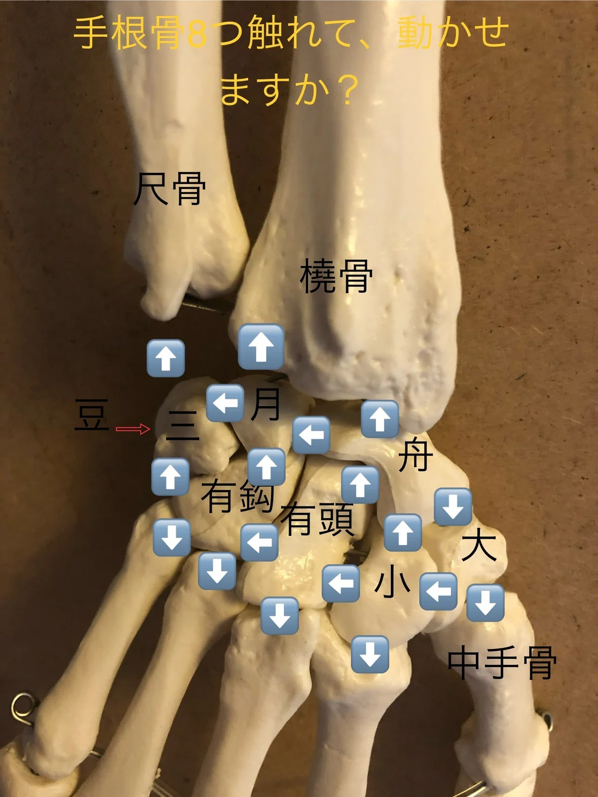 手首の骨折、どうして骨はついたのに痛みがとれないし、手首は固いの!|理学療法士 青柳