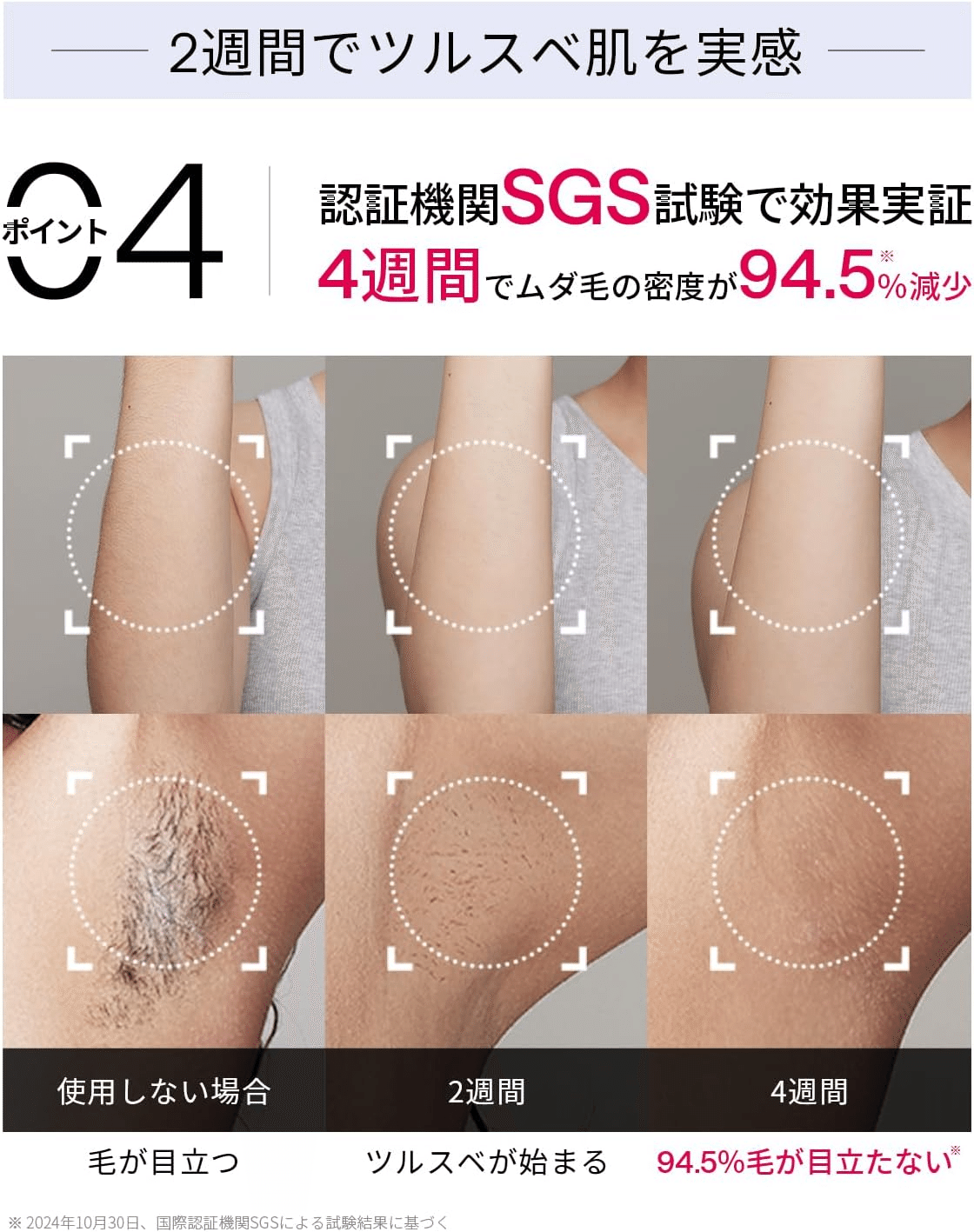Ulike 脱毛器 AirPro Sサファイア冷却技術でほぼ無痛　2週間で効果 Amazon | 【正規品】Ulike 脱毛器 AirPro S【メーカー2年保証