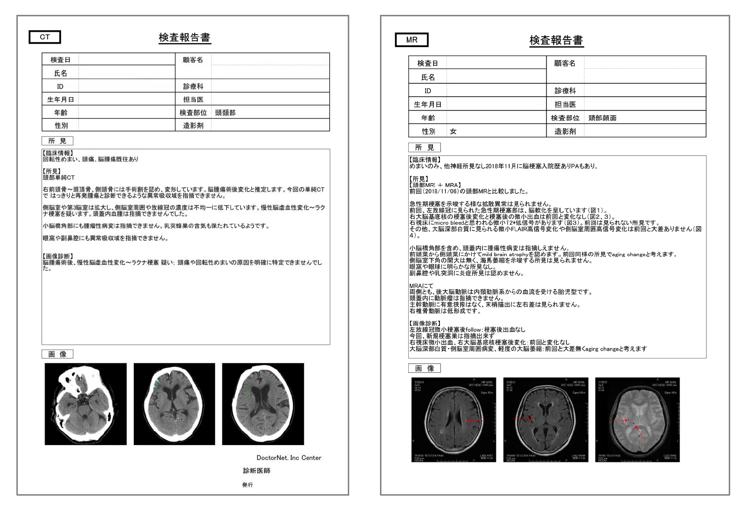 読影レポート」って何？ 診断の裏側を支える、見えないやりとり