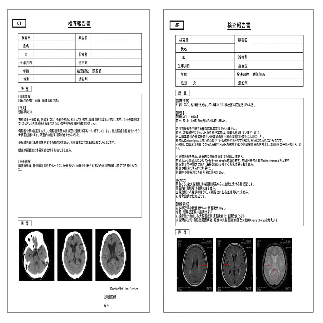 読影レポート」って何？ 診断の裏側を支える、見えないやりとり