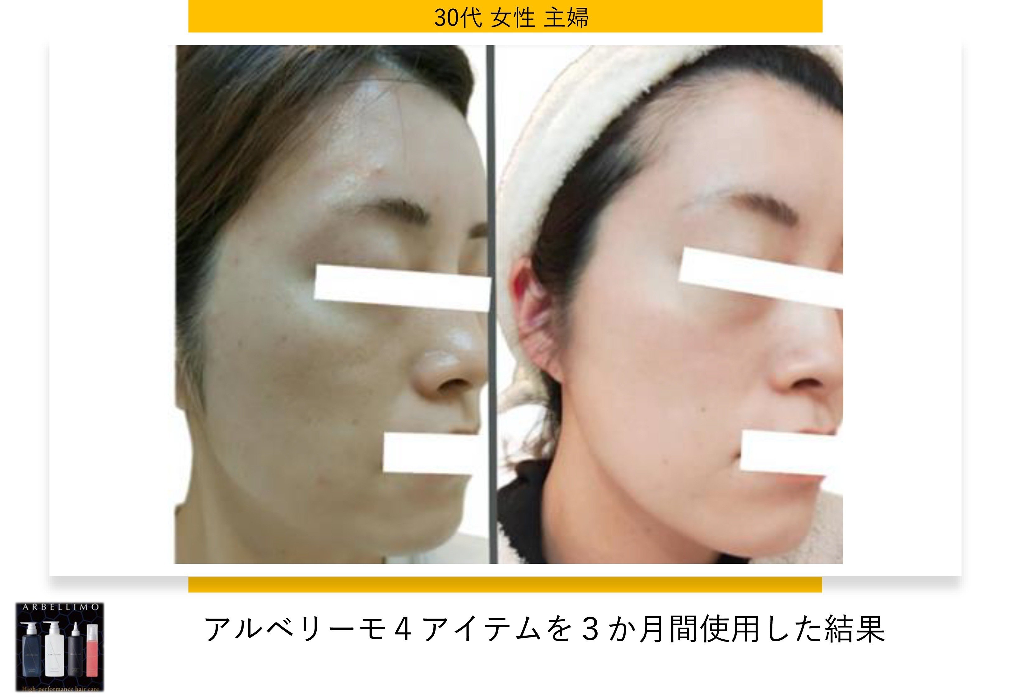 頭皮から小顔へ“上がるシャンプー”で話題の《アルベリーモ》とは