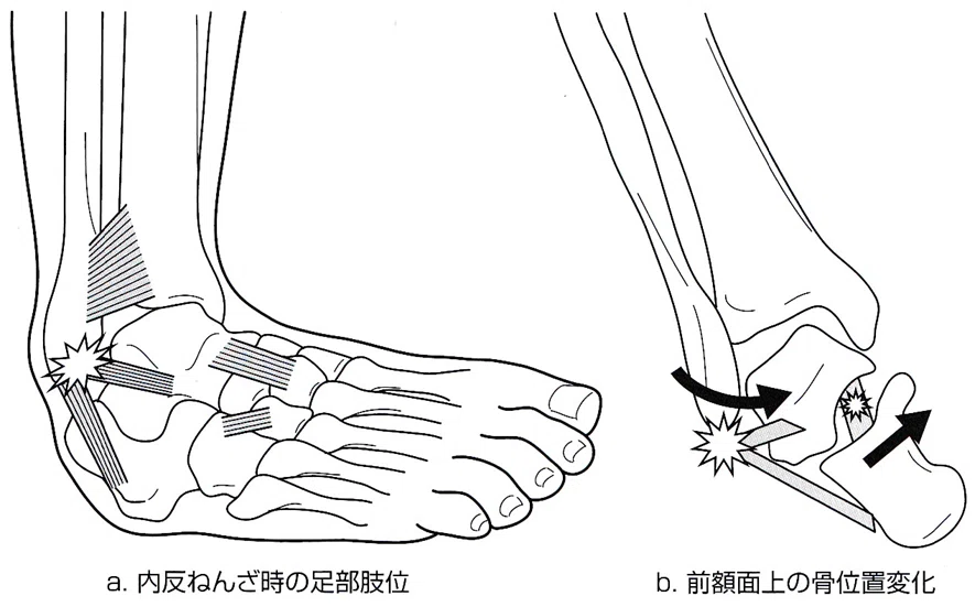 フォロワー250名突破記念～足関節・足部の診かたに対する考え方