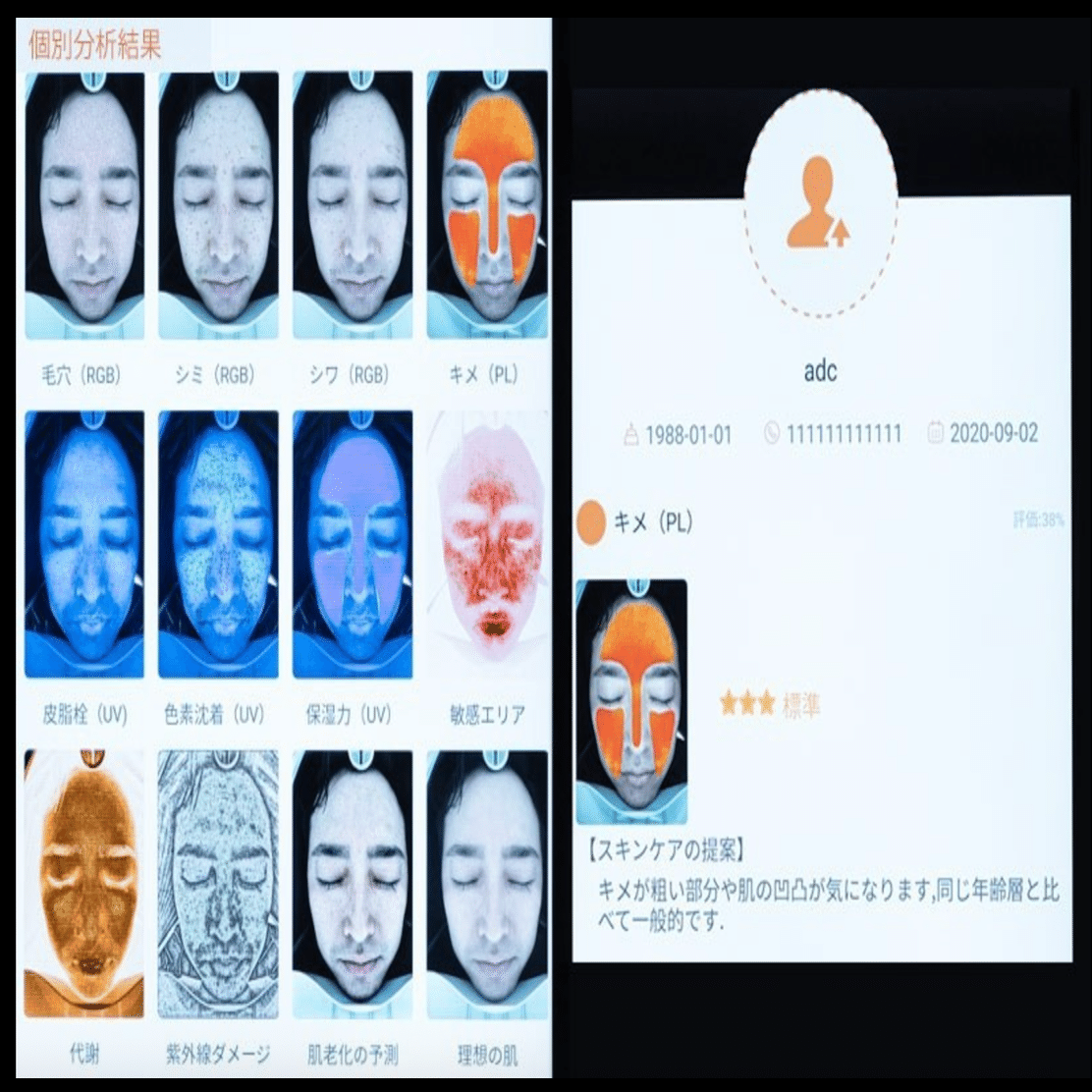 伊勢丹新宿店メンズ館の「肌測定サービス」試してきた。【スマート