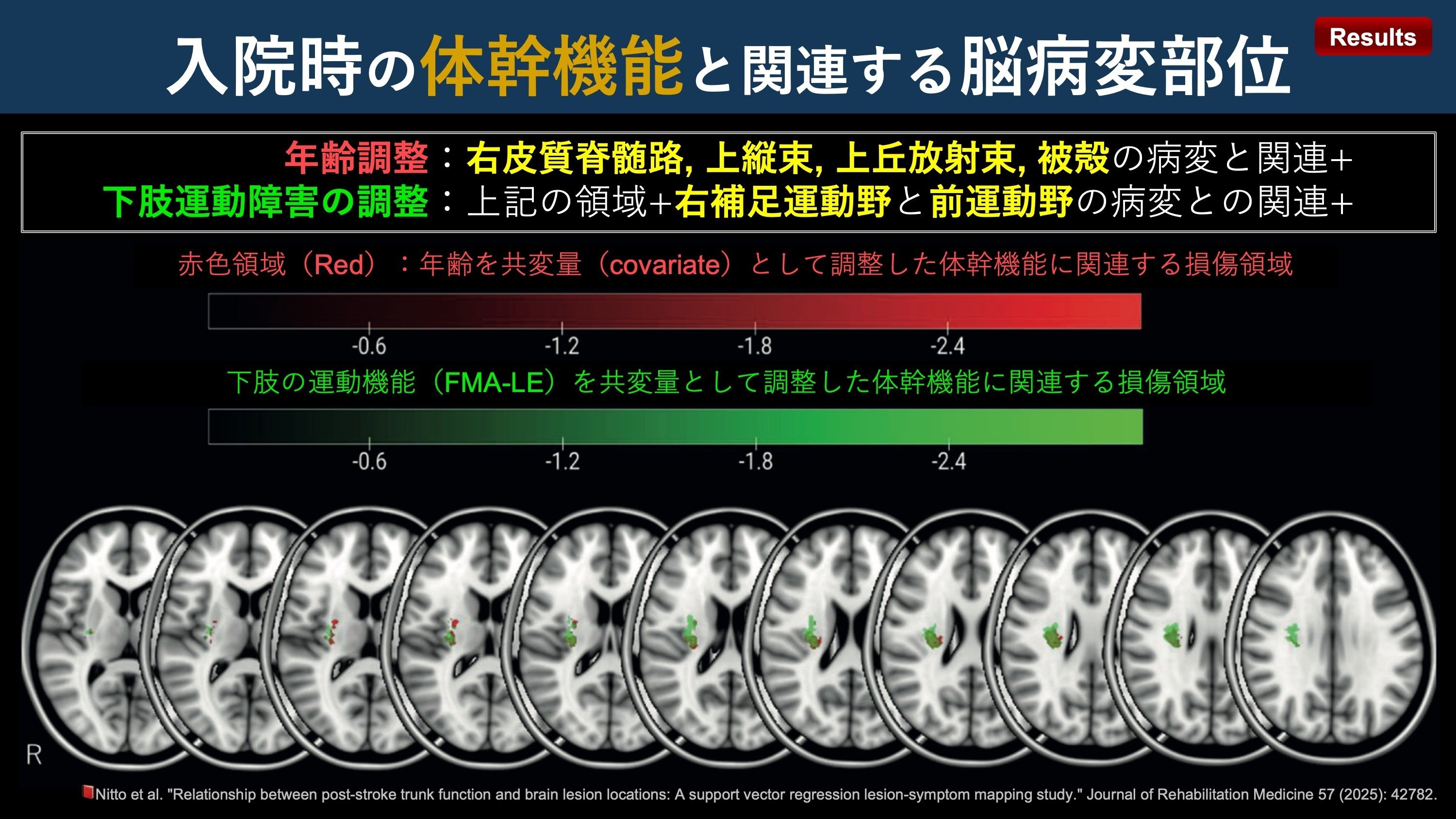 脳損傷後の機能回復: 治療・訓練の理論的根拠 運動麻痺回復のステージ理論とは？運動麻痺回復の脳内メカニズム