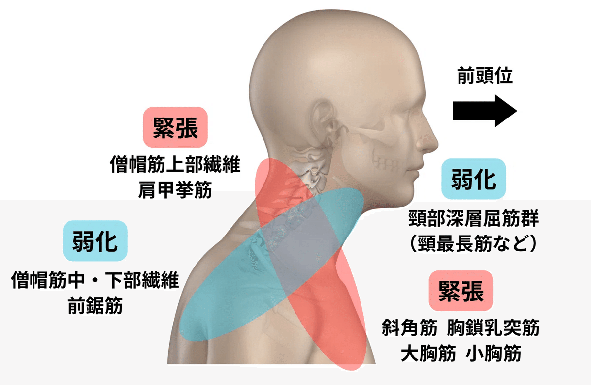 小胸筋の機能解剖学と臨床評価アプローチ【サブスク】｜理学療法