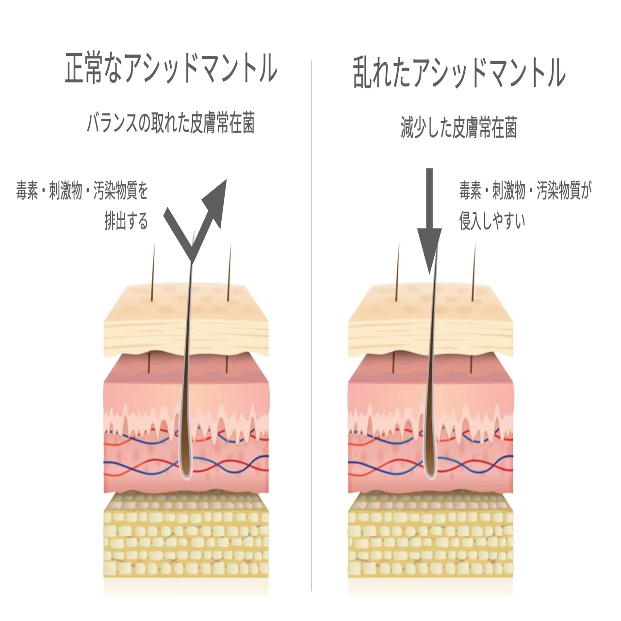 皮膚理論の基礎②｜pHとマイクロバイオーム｜近久智美｜皮膚学講師