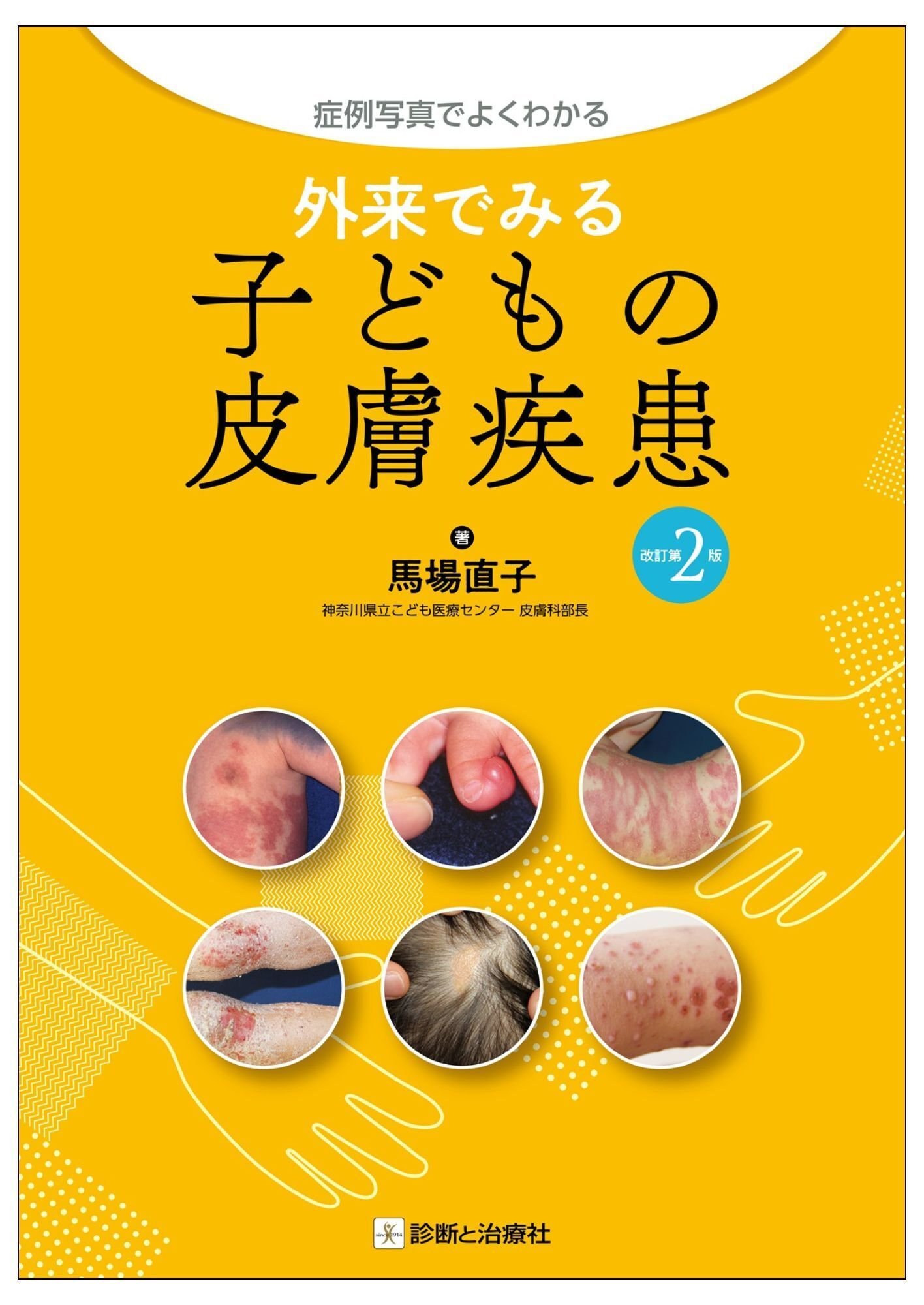 【裁断済み】子供の皮膚診療を極めるために 小児科診療 2024年春 子どもの皮膚診療を極めるために 2024年 04 月号 [雑誌]: 小児科