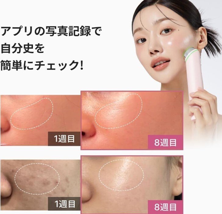 2025年最新】メディキューブ AGE-Rブースタープロ完全ガイド！1台6役の