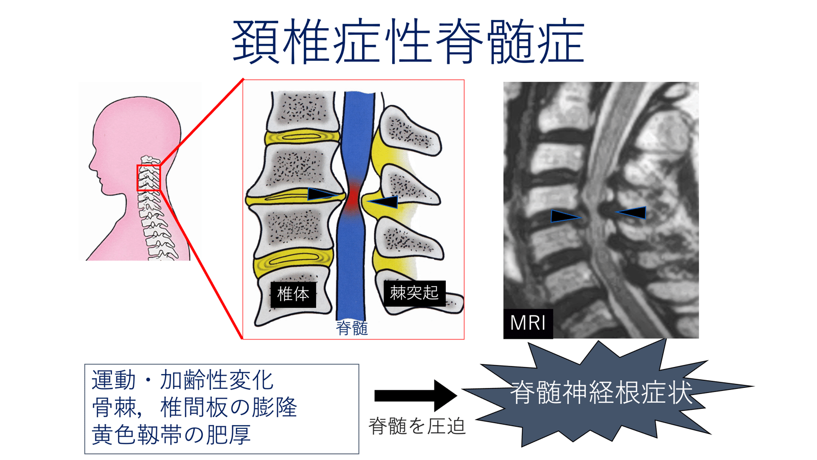脊椎脊髄病学 裁断済脊椎脊髄病学 第3版 m3電子書籍
