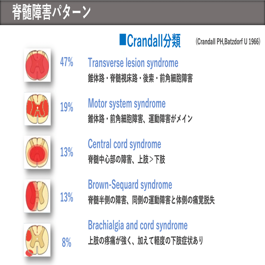 圧迫性脊髄症（頚椎症性脊髄症）とは｜【頸椎執刀数/本邦最多級
