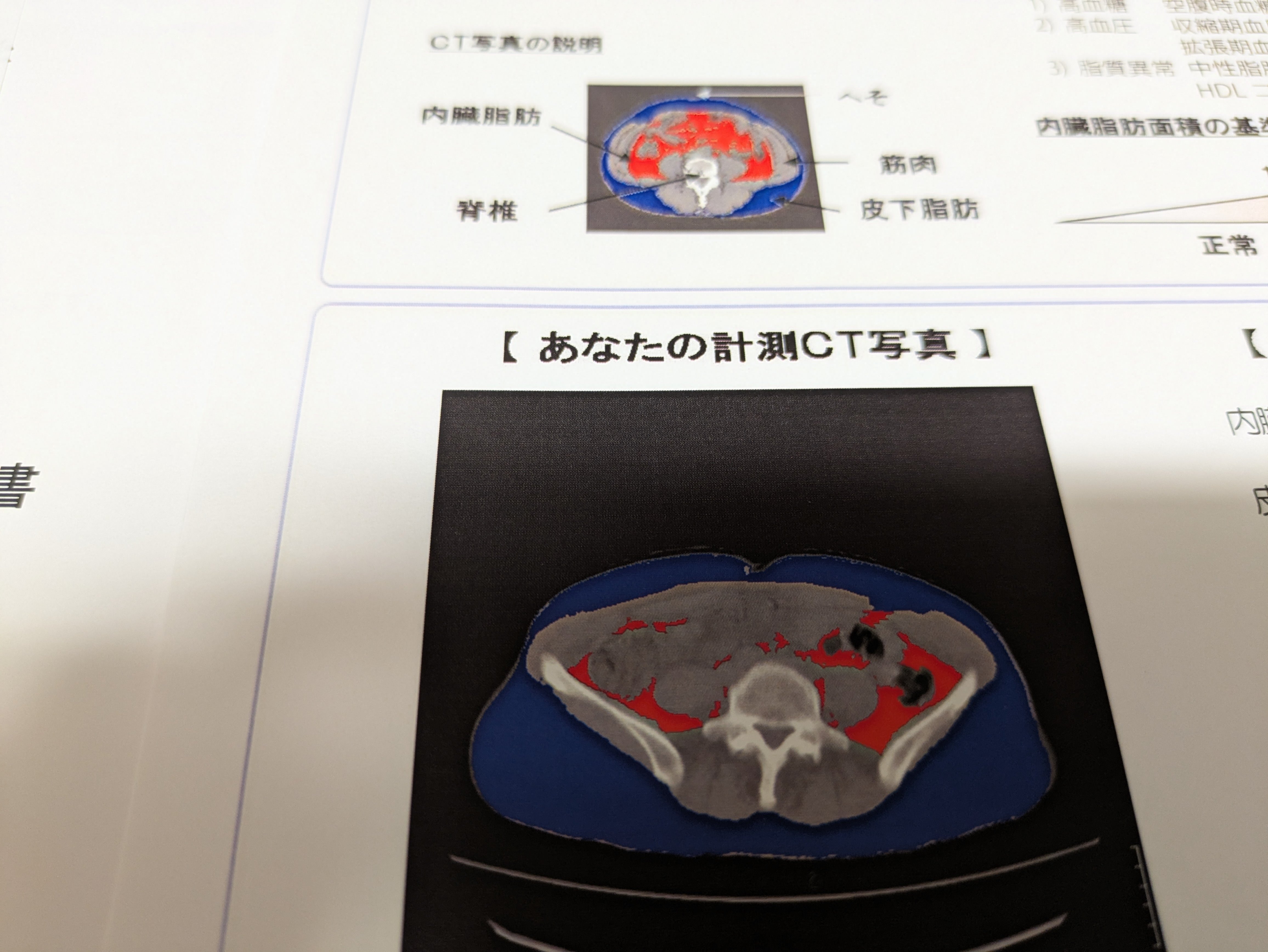 勝手にお披露目結果発表！ ～ 人間ドック ～｜TSN