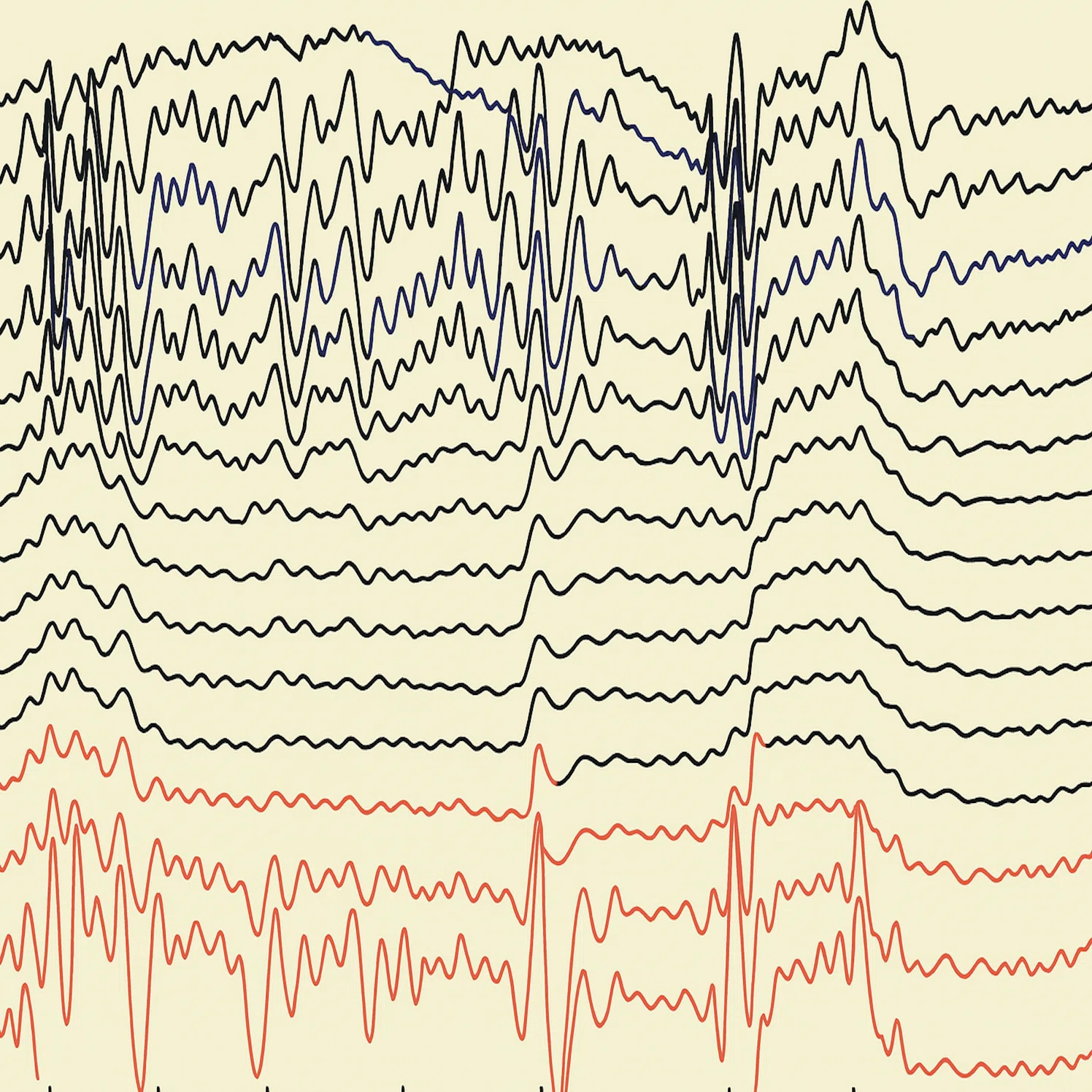 Differences between sleep EEG and epileptiform discharges