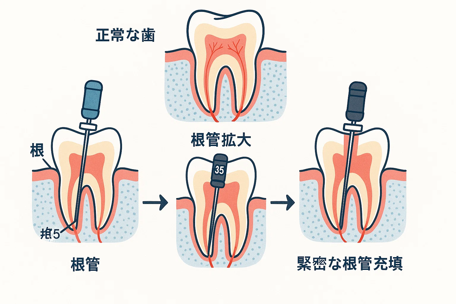 臨床根管解剖学 【公式通販】