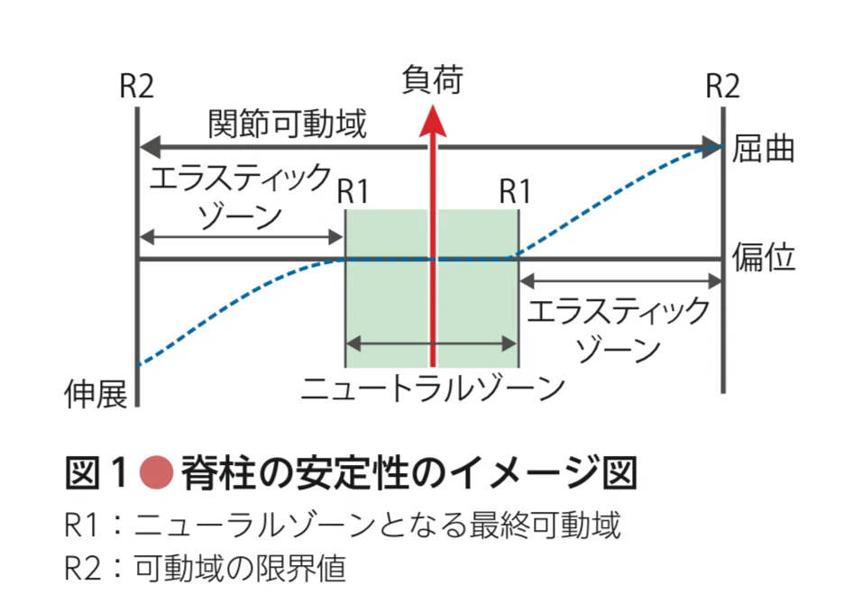 脊柱の安定性を示す図。ニュートラルゾーンとエラスティックゾーンの関係