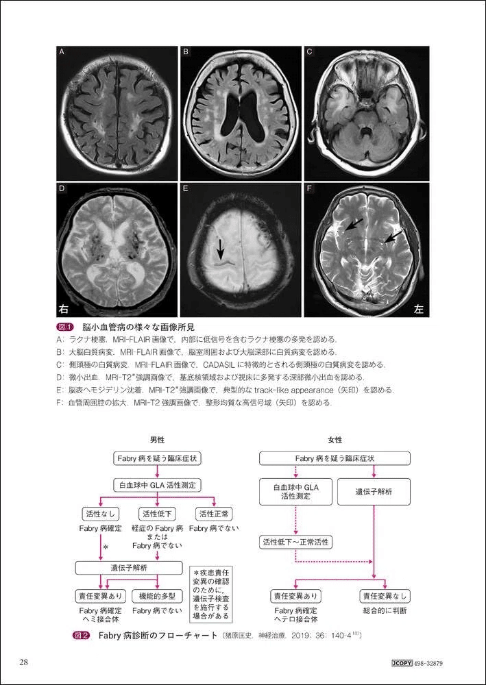 脳神経内科を目指す若手へ： 必携の医学書ガイド10選（2025年度