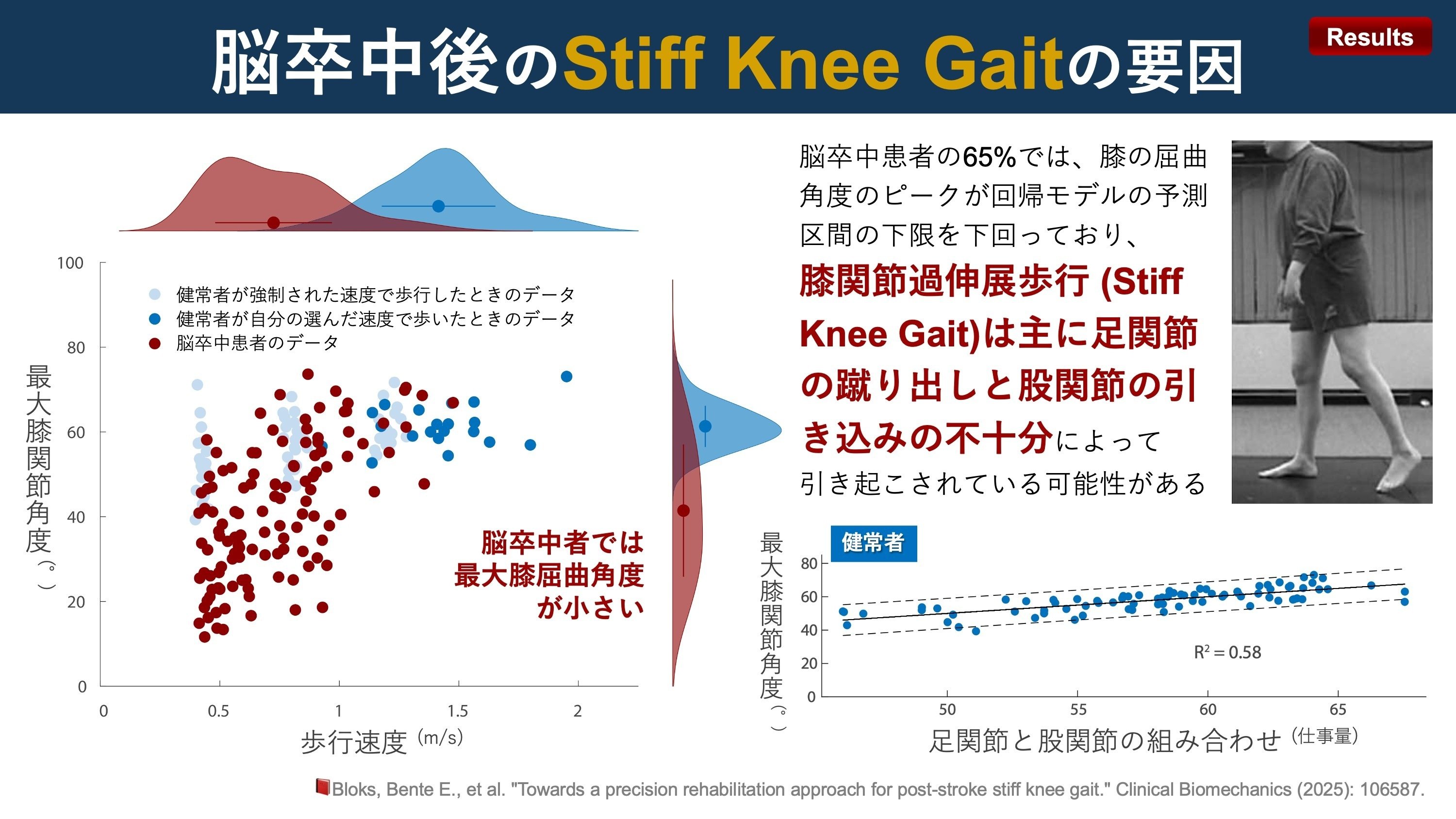 理学療法マネジメント　脳卒中　股関節　膝関節　足部・足関節　肩関節　脊柱　セット 脳卒中後の膝関節過伸展4つのパターンとその要因｜Super Human