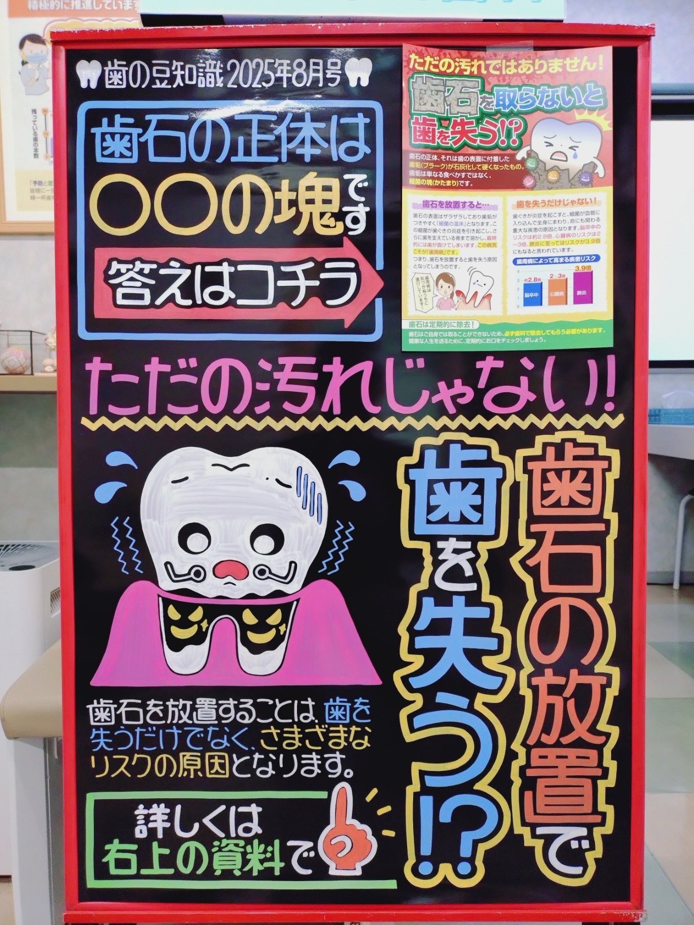 歯石の正体とは・・・？｜いずみ中山歯科