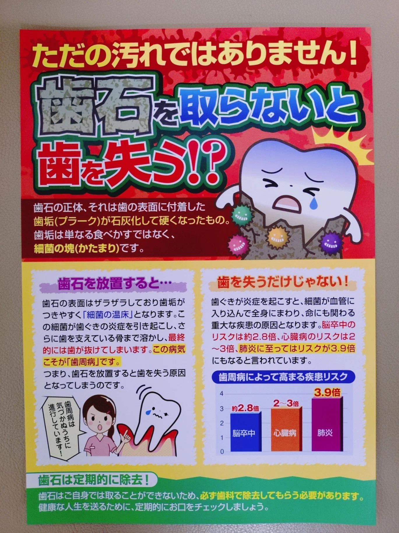 歯石の正体とは・・・？｜いずみ中山歯科