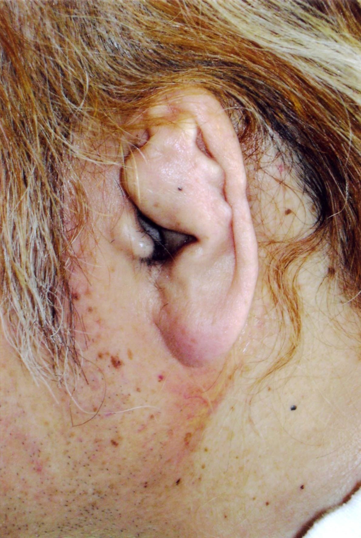 初めて明かそう、私の左耳は聴力がまったくなかった【上田馬之助連載#2