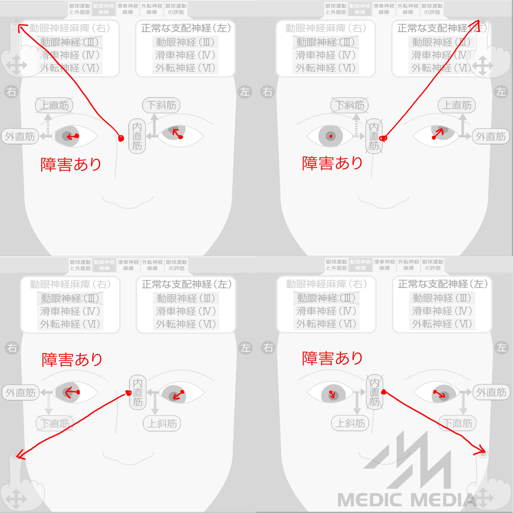 病みえ』の診察ができる眼球運動シミュレーターを作った話｜MIG