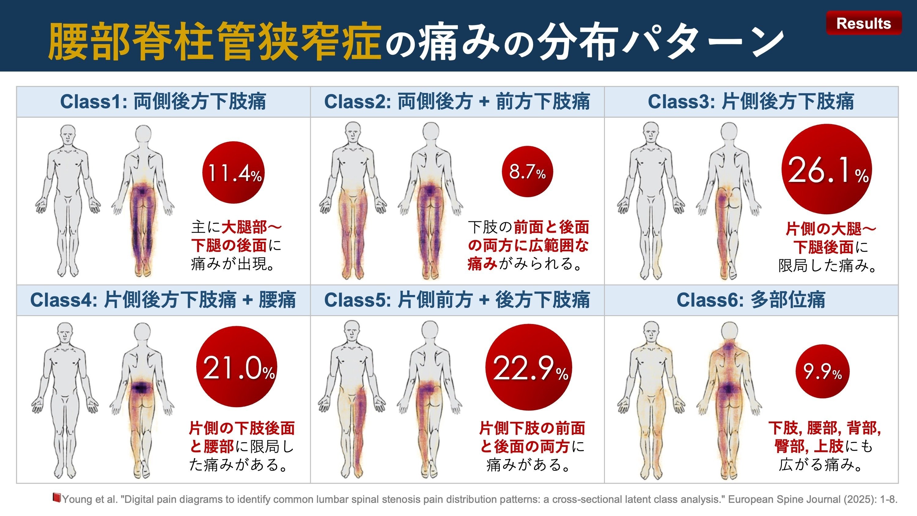 図説腰椎の臨床 低侵襲手術｜【山川 知之】腰部脊柱管狭窄症や腰椎椎間板