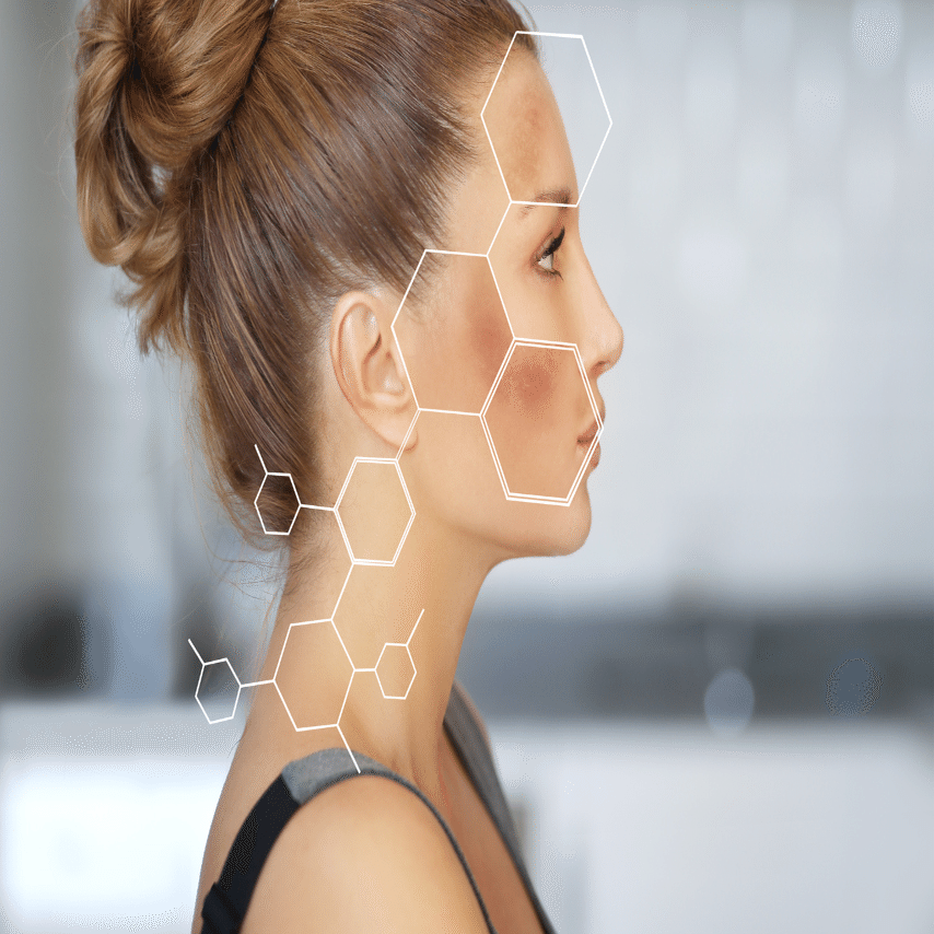 1ヶ月ぶりのエステ！2回目の水光肌エステ体験レポ｜まみ子